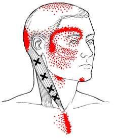 scm-trigger-points-1269542140